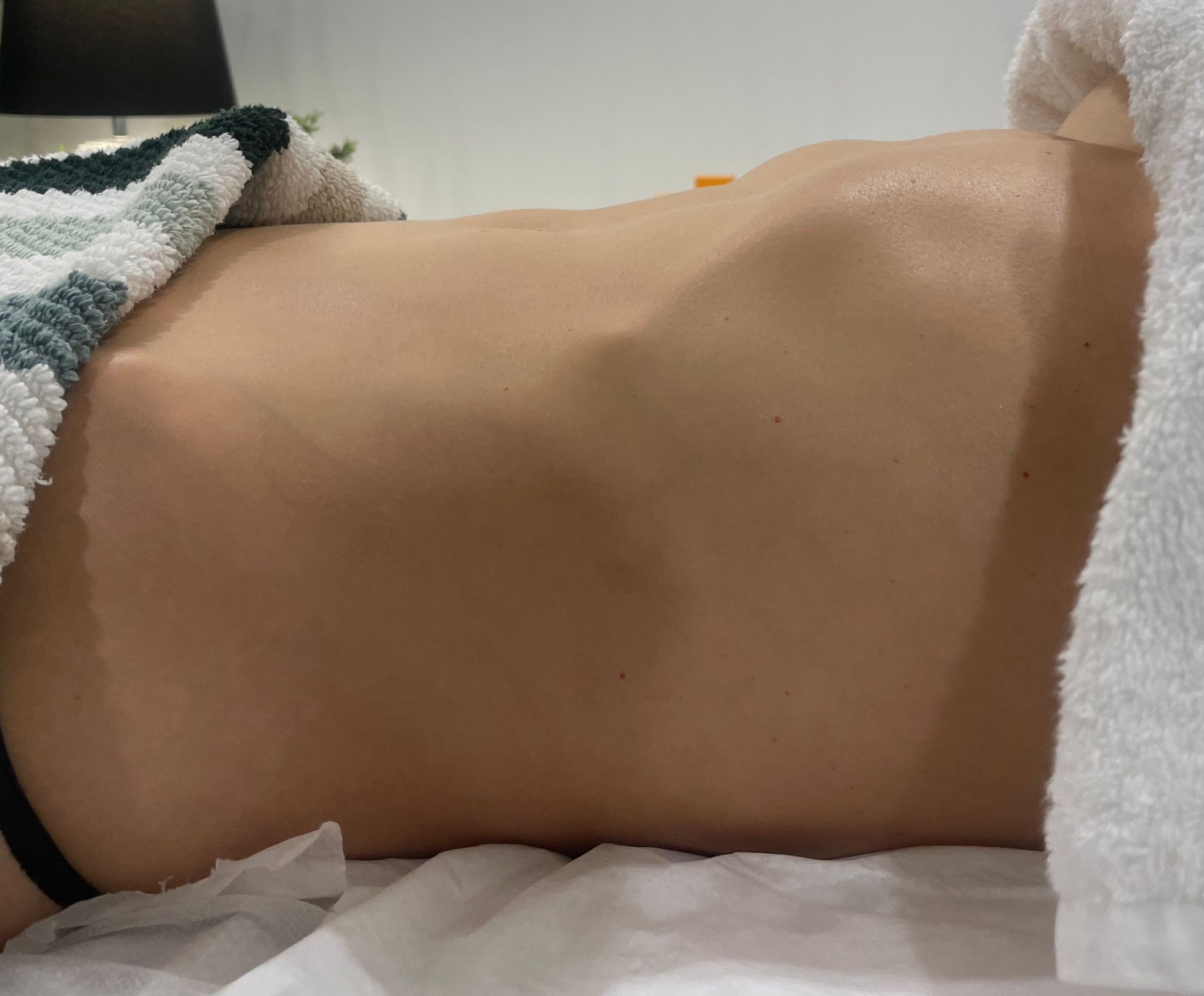Before lymphatic drainage massage - abdominal bloating